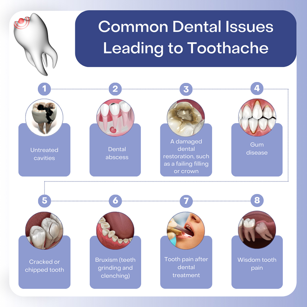 Common Dental Issues Leading to Toothache