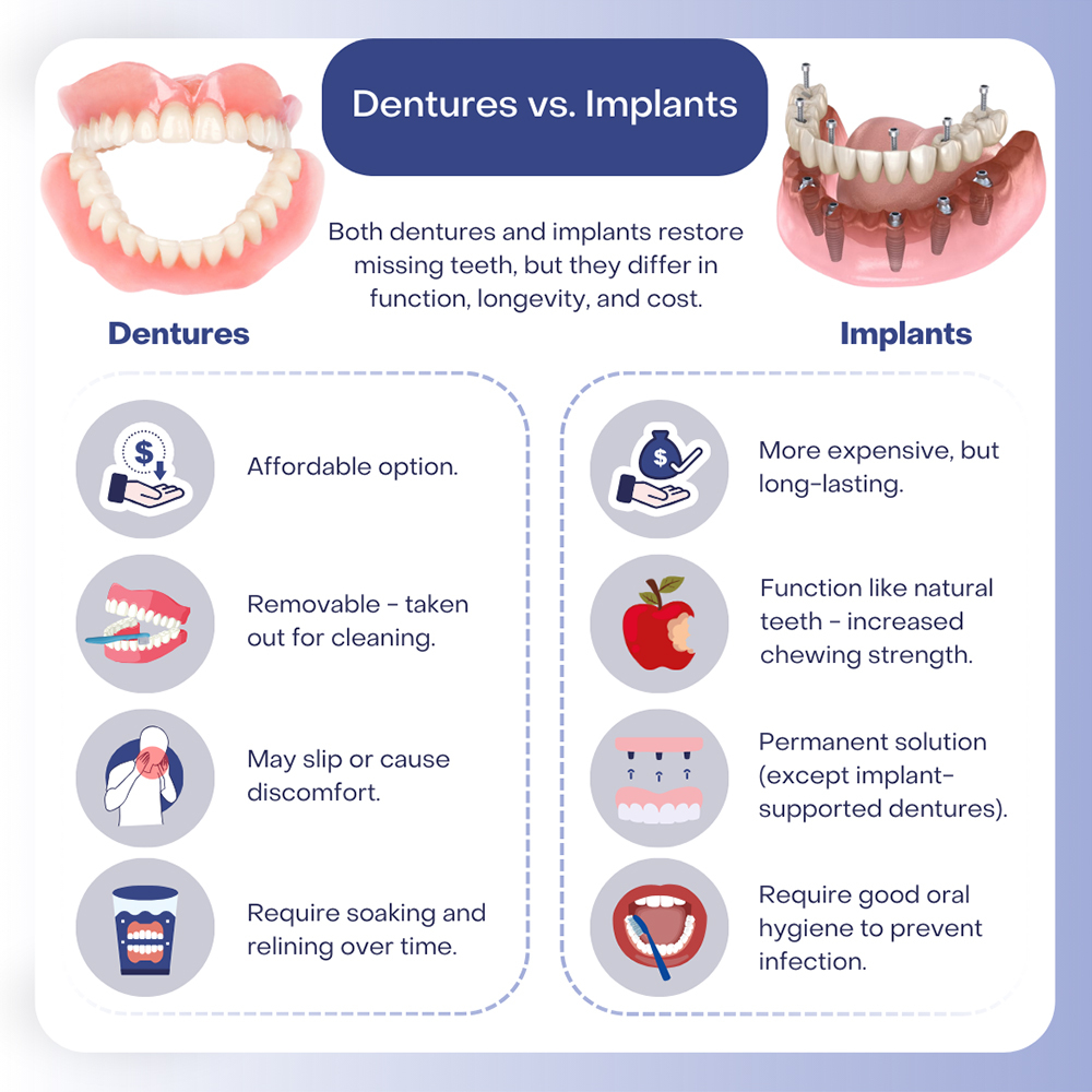Dentures vs Implants