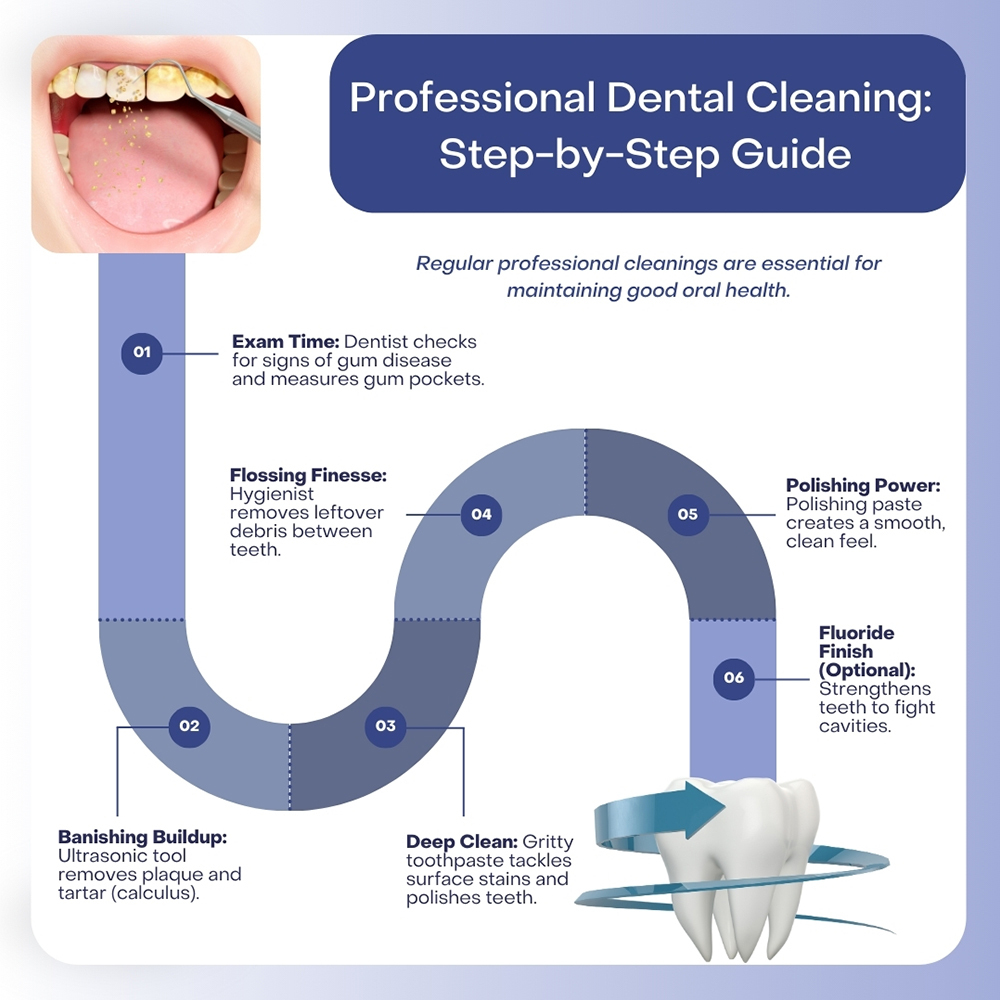 Professional Dental Cleaning Step by Step Guide