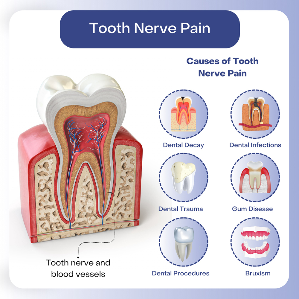 Tooth Nerve Pain Treatment Hackensack My New Jersey Dentist