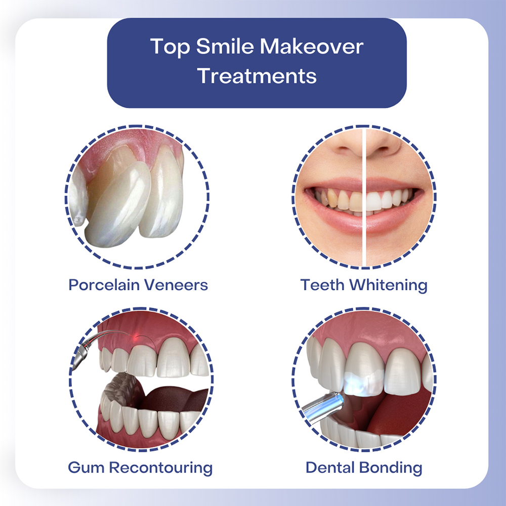Smile Makeover Treatments