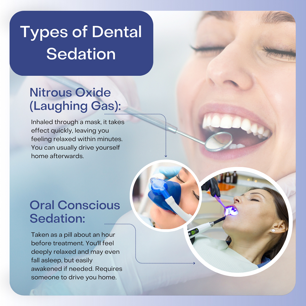 Types of Sedation Dentistry